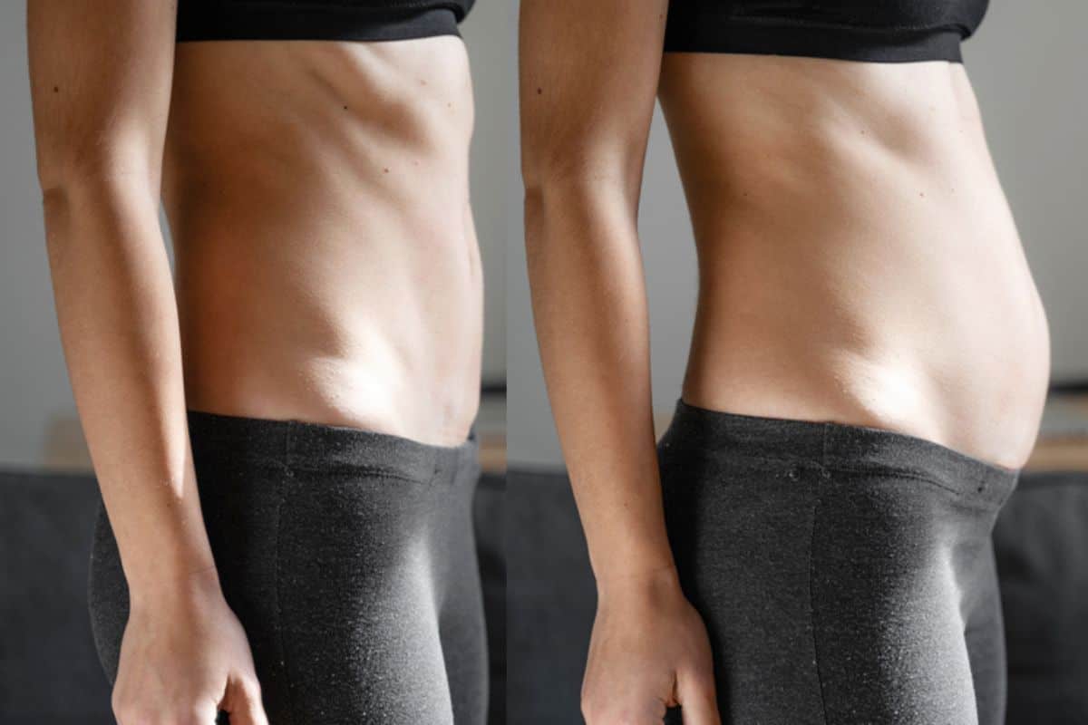 How long does diastasis recti take to improve Walham Green?