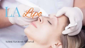 Woman receiving Actinic Keratosis Removal Treatment Walham Green