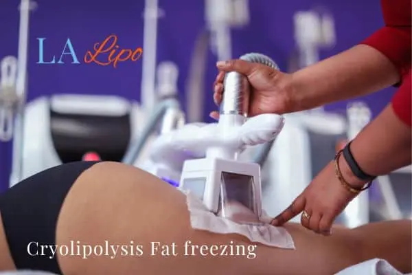 women getting fat freezing Walham Green