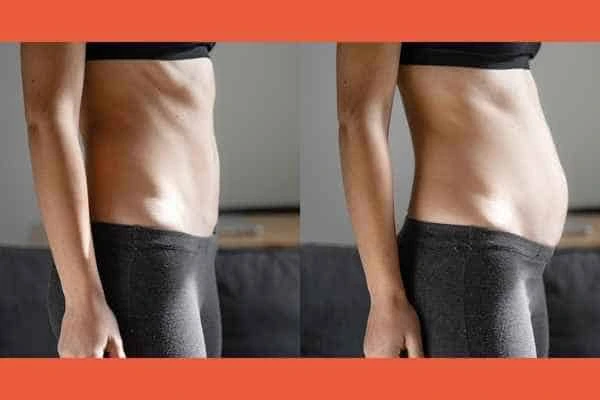 LA-EMS Body Sculpting results Walham Green