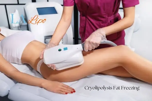 Woman receiving coolsculpting Walham Green treatment on her thighs