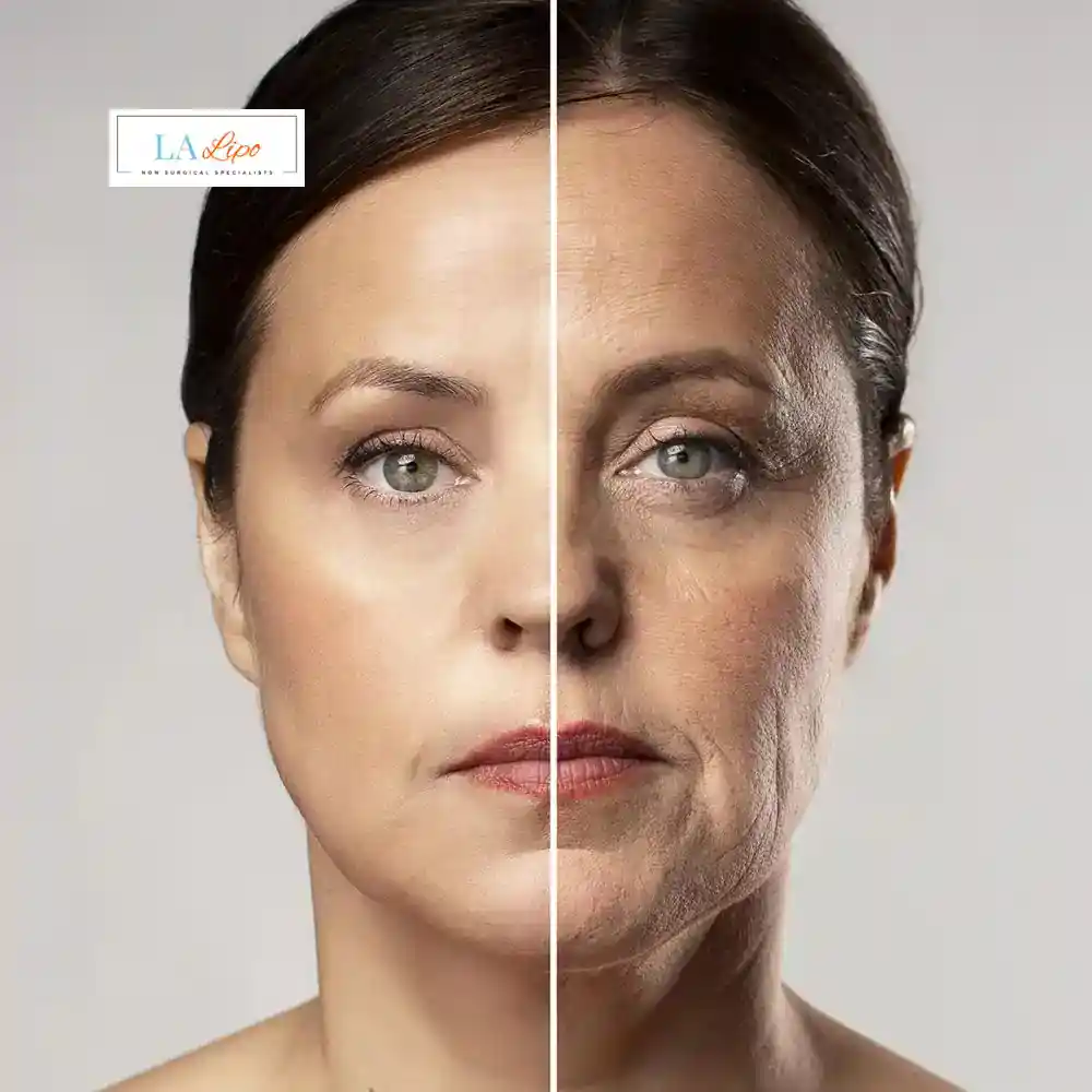 How Can You Tell If Non-Surgical Skin Tightening Is Right for You Walham Green?