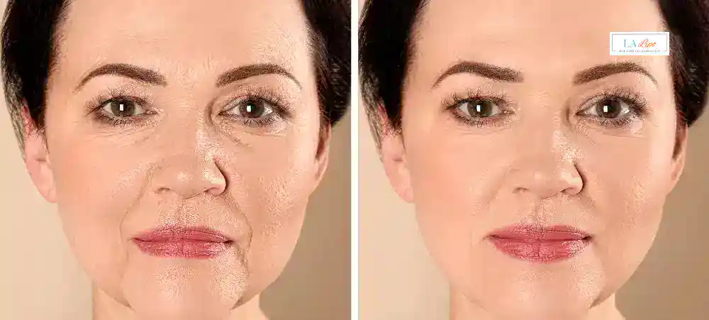 Why Aren’t My Skincare Products Making My Sagging Skin Look Firmer Walham Green?