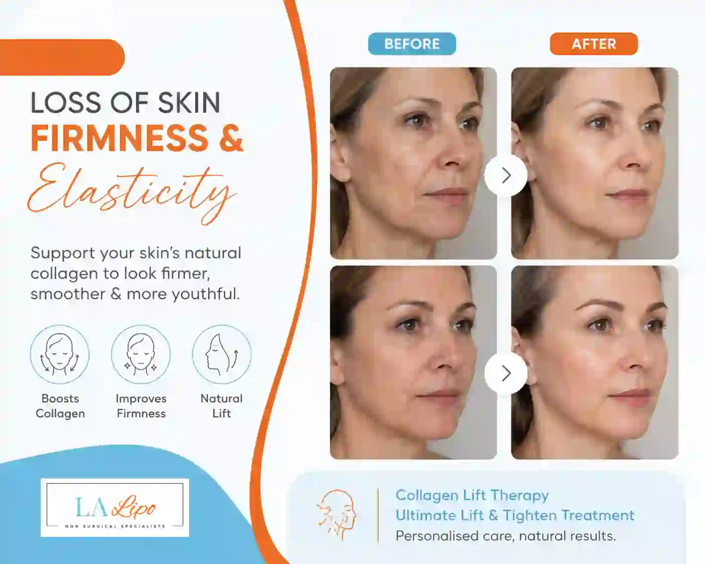Sign #7: Loss of Skin Firmness and Elasticity Walham Green